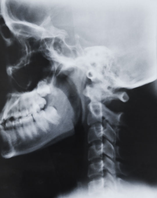 交通事故特別治療