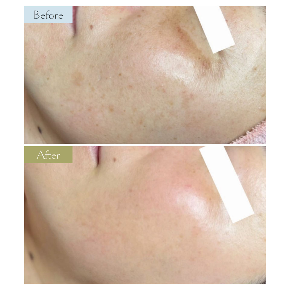 40代のお客様(約5年ご来店)